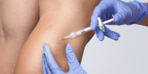 Sclerotherapy